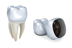 Veltkamp Family Dentistry | Lynden, WA Dentists | Porcelain Dental Crowns